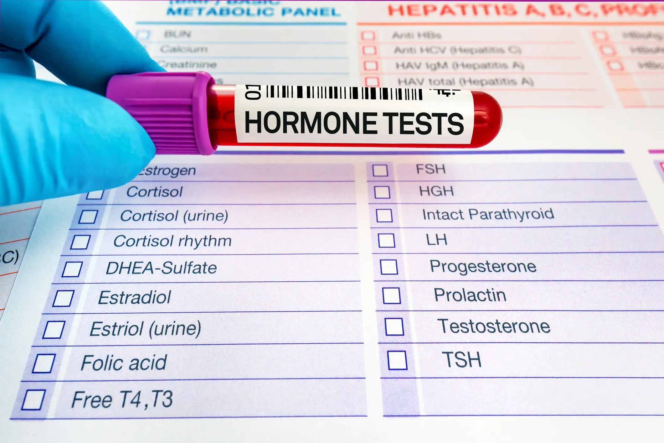 Gloved hand holding a blood sample vial labeled 'Hormone Tests'.