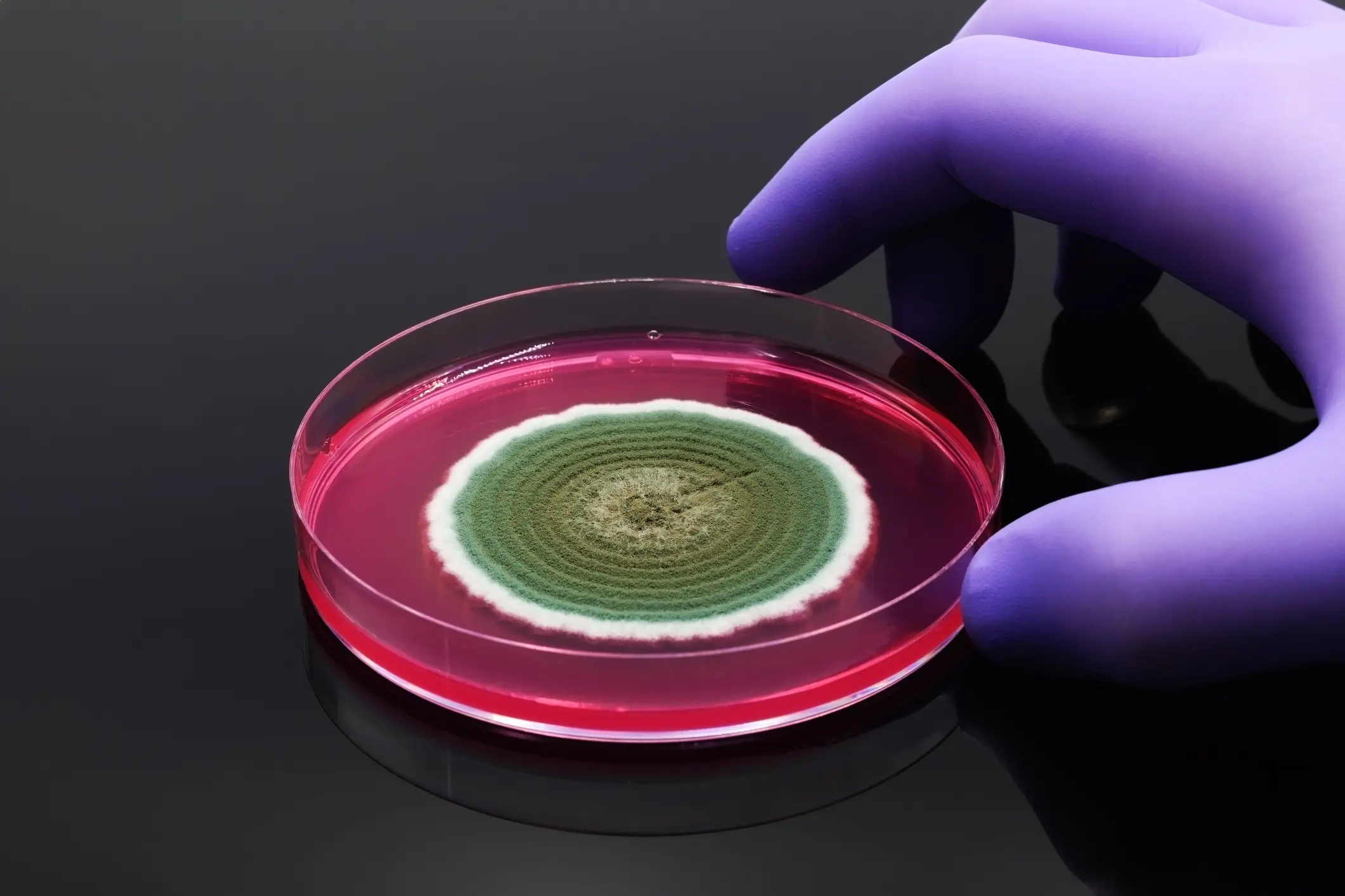 Gloved hand holding petri dish with green mold growth.