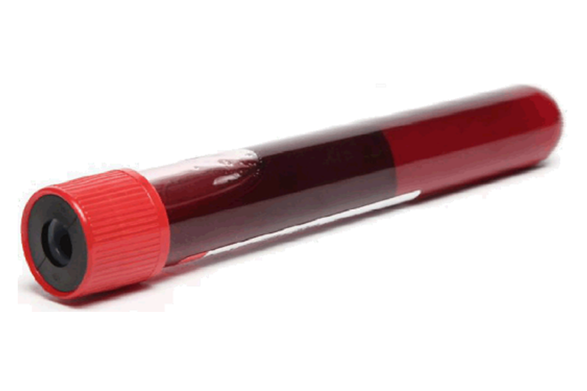 A test tube filled with dark red blood and a red cap.